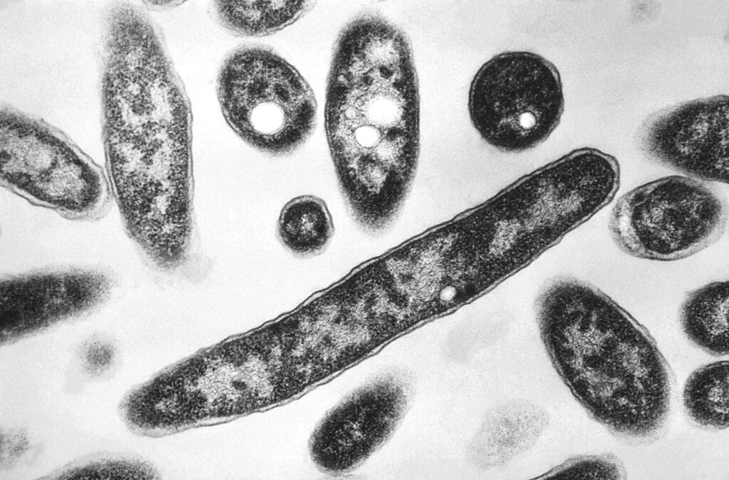 Legionnaires Disease